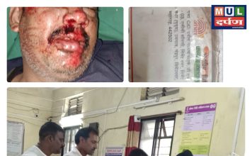 अपघातात दुचाकीस्वार गंभीर जखमी; डिव्हायडरला धडकल्याची माहिती